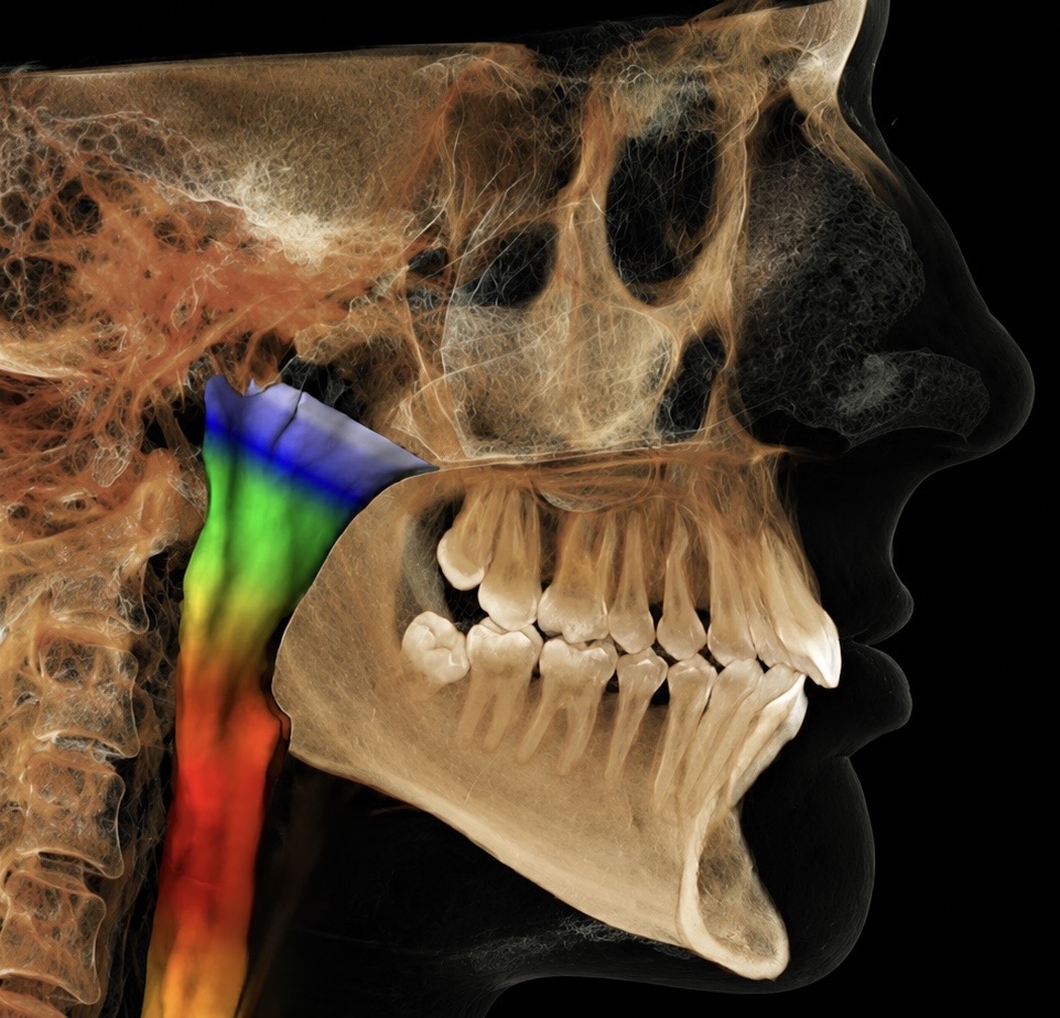 Airway-focused orthodontic analysis and treatment planning